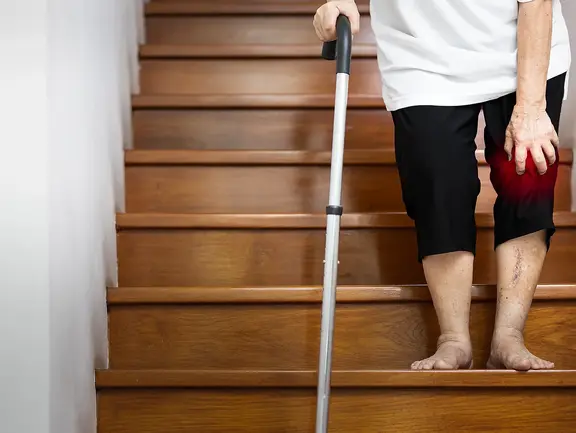 Patient hat Probleme beim Absteigen einer Treppe: mögliche Komplikationen bei einer Arthrose